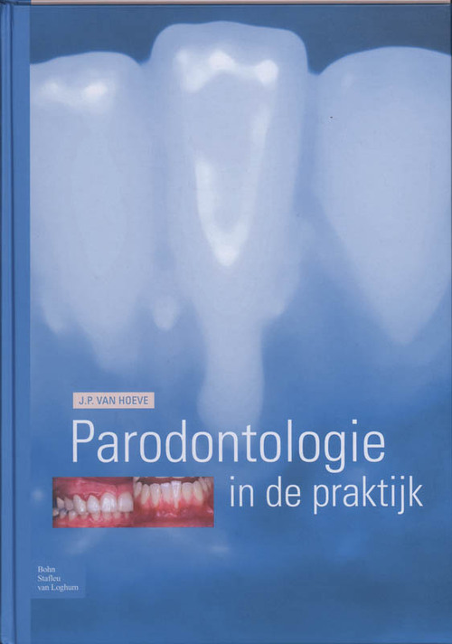 Parodontologie in de Praktijk -  J.P. van Hoeve (ISBN: 9789031351756)
